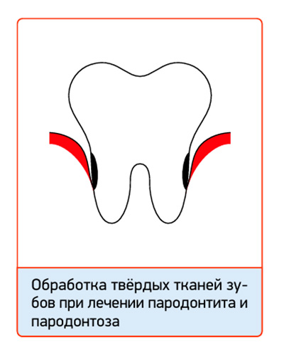 СМ_Флюор_06